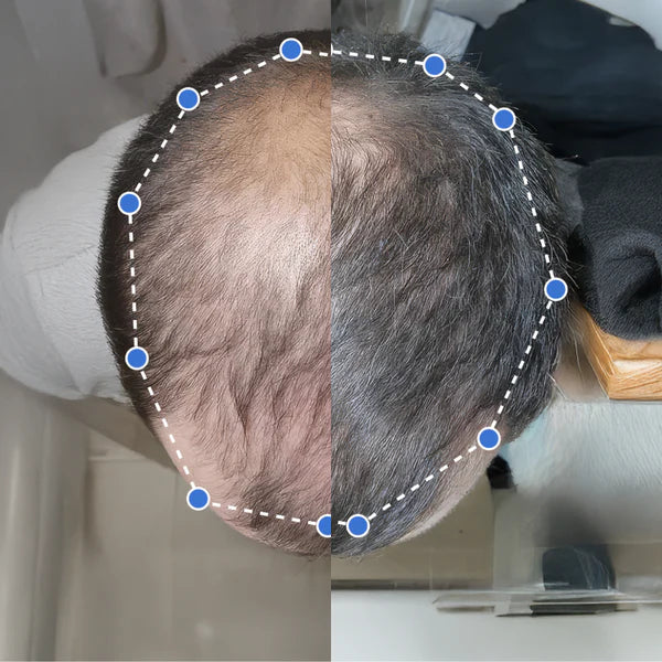 Capil Up - Sérum para el crecimiento del cabello