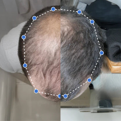 Capil Up - Sérum para el crecimiento del cabello